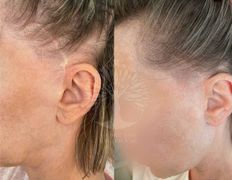 Студия красоты INTUITION (Интуишн), Трихопигментация - фото 7