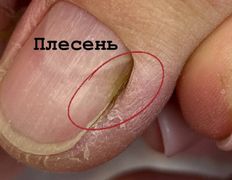 Студия ногтевого сервиса VVStudio (ВВСтудио), Подология - фото 11