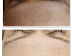 Салон красоты FaceЛik (ФейсЛик), Процедуры по уходу - фото 4