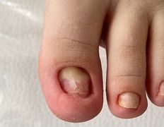 Студия подологии и эстетики  Moipodolog (Мой подолог), Подология - фото 10