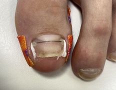 Студия ногтевого сервиса VVStudio (ВВСтудио), Подология - фото 18