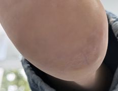 Студия подологии и эстетики IloNails studio (ИлоНеилс студио), Подология - фото 13