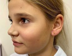 Эстетический центр Grandessa (Грандесса), Прокол ушей и пирсинг - фото 7