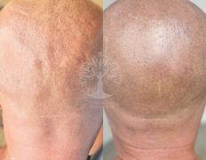 Студия красоты INTUITION (Интуишн), Трихопигментация - фото 4