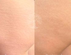 Студия красоты INTUITION (Интуишн), Эстетический камуфляж - фото 9