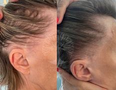 Студия красоты INTUITION (Интуишн), Трихопигментация - фото 8