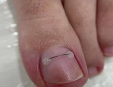 Студия ногтевого сервиса VVStudio (ВВСтудио), Подология - фото 5