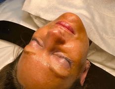 Салон красоты Yesbeauty (Есбьюти), Примеры работ: топ-косметик Дмитрий - фото 6