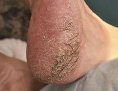 Эстетический центр Grandessa (Грандесса), Педикюр ADN - фото 4