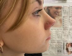 Косметический кабинет Медикал Бьюти на Востоке, Примеры работ - фото 17