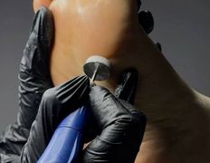 Студия ногтевого сервиса VVStudio (ВВСтудио), Подология - фото 2