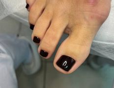 Студия подологии и эстетики  Moipodolog (Мой подолог), Педикюр - фото 3