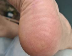 Эстетический центр Grandessa (Грандесса), Педикюр ADN - фото 1