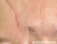 Студия красоты INTUITION (Интуишн), Эстетический камуфляж - фото 7