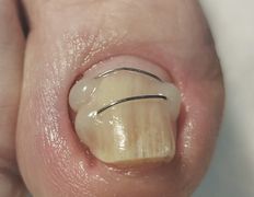 Салон красоты Шевелюра, Подология - фото 3