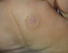 Студия ногтевого сервиса VVStudio (ВВСтудио), Подология - фото 8