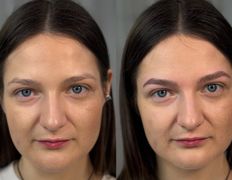 Студия взгляда Rainl studio (Райнль Студио), Примеры работ - фото 12