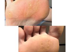null Кабинет подологии Любови Казнаковой, Галерея - фото 6