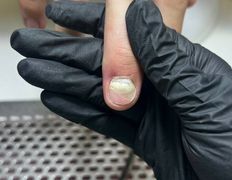 Студия подологии и эстетики  Moipodolog (Мой подолог), Подология - фото 5