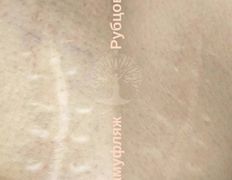 Студия красоты INTUITION (Интуишн), Эстетический камуфляж - фото 3