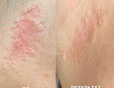 Студия красоты INTUITION (Интуишн), Эстетический камуфляж - фото 10