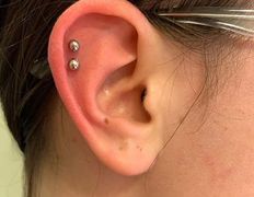 Косметический кабинет Медикал Бьюти на Востоке, Примеры работ - фото 1