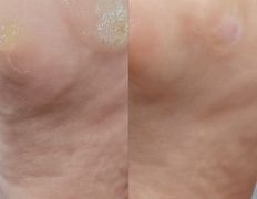 Салон красоты Шевелюра, Подология - фото 7