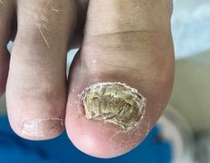 Студия подологии и эстетики  Moipodolog (Мой подолог), Подология - фото 19