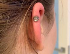 Косметический кабинет Alisan-med (Алисан-мед), Примеры работ - фото 13