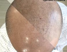 Студия красоты INTUITION (Интуишн), Трихопигментация - фото 2