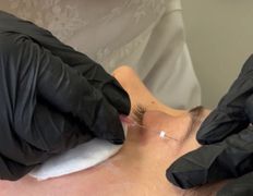 Салон красоты ORIENTAL (Ориентал), Инъекционные процедуры - фото 10