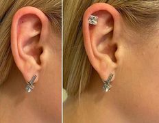 null Студия пирсинга на Притыцкого, Примеры работ - фото 11