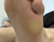 Студия подологии и эстетики IloNails studio (ИлоНеилс студио), Подология - фото 11