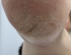 Студия подологии и эстетики IloNails studio (ИлоНеилс студио), Подология - фото 14