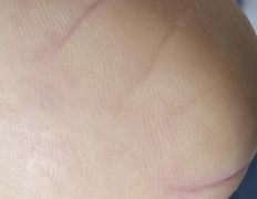 Эстетический центр Grandessa (Грандесса), Педикюр ADN - фото 2