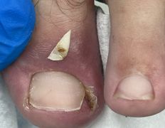 Студия подологии и эстетики IloNails studio (ИлоНеилс студио), Подология - фото 17