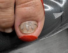 Центр подологии и маникюра Студия 56, Примеры работ - фото 4