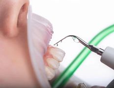 null Центр имплантации и цифровой стоматологии Доктора Шабановича, Галерея - фото 5