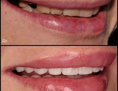 Стоматология Триомед, Примеры работ - фото 5