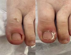 Студия ногтевого сервиса VVStudio (ВВСтудио), Подология - фото 12