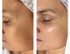 Салон красоты FaceЛik (ФейсЛик), Процедуры по уходу - фото 5