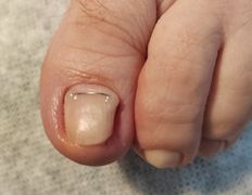 Салон красоты Шевелюра, Подология - фото 5