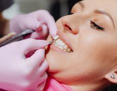 Стоматология Аксисдент, Галерея - фото 14